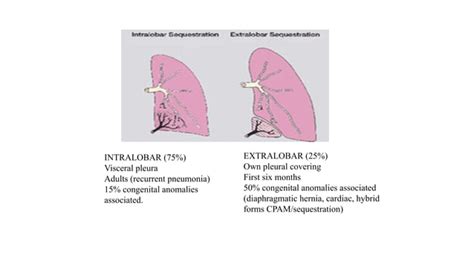 ccpamd|cpam vs bronchopulmonary sequestration.